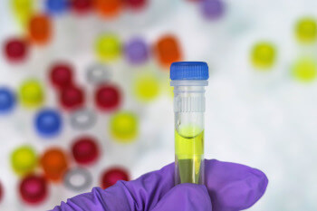 Eine kleines Teströhrchen mit einer Urinprobe